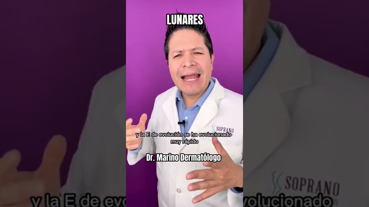 ¿CUÁNDO ME DEBO PREOCUPAR POR UN LUNAR?