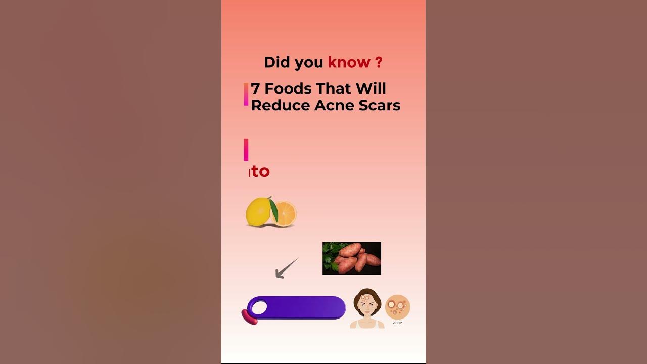 7-foods-that-will-reduce-acne-scars-shorts-viral-food-youtube