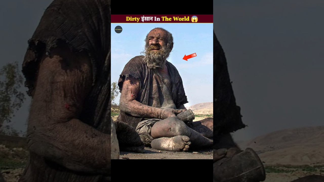 🤯 94 साल तक जिंदा रहने वाले दुनियां के सबसे 'गंदे' इंसान। 😱 