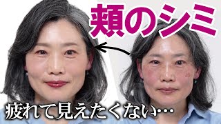 [Large, dark spots on the cheeks] What's the best combination of concealer and blush? I don't wan... screenshot 5