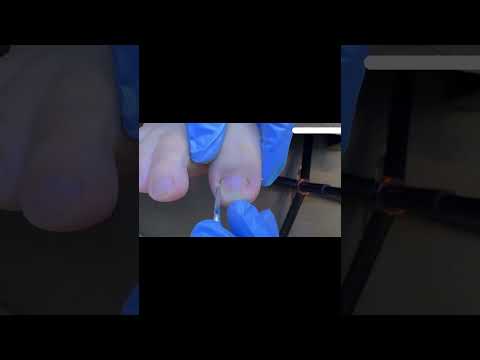 These real-life photos are truly amazing!#foot  #pedicure  #automobile #vlog