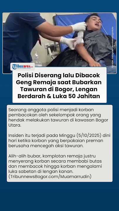 Niat Lerai Tawuran, Anggota Polisi di Bogor Dibacok Remaja Berandal hingga Alami Luka di Lengan