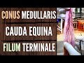 Spinal Meninges | Cauda Equina | Conus Medullaris | Filum Terminale || Air Anatomy