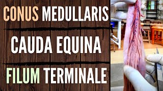 Spinal Meninges Cauda Equina Conus Medullaris Filum Terminale Air Anatomy