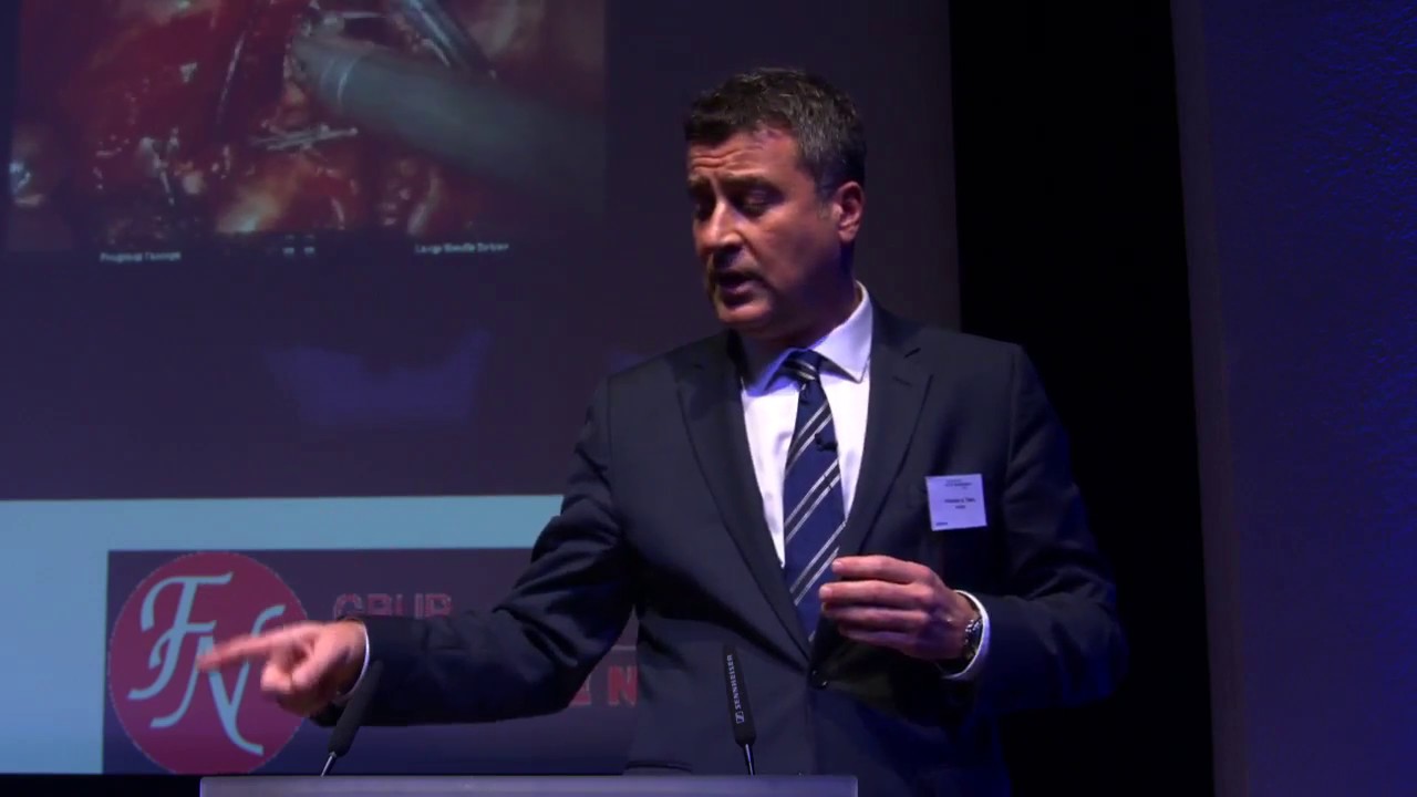 MD Alper Toker 's Presentation during The 4th Int. VATS Symposium ...