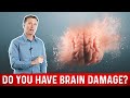 Quick Way To Know If You Have Brain Damage Quick Way To Know If You Have Brain Damage
