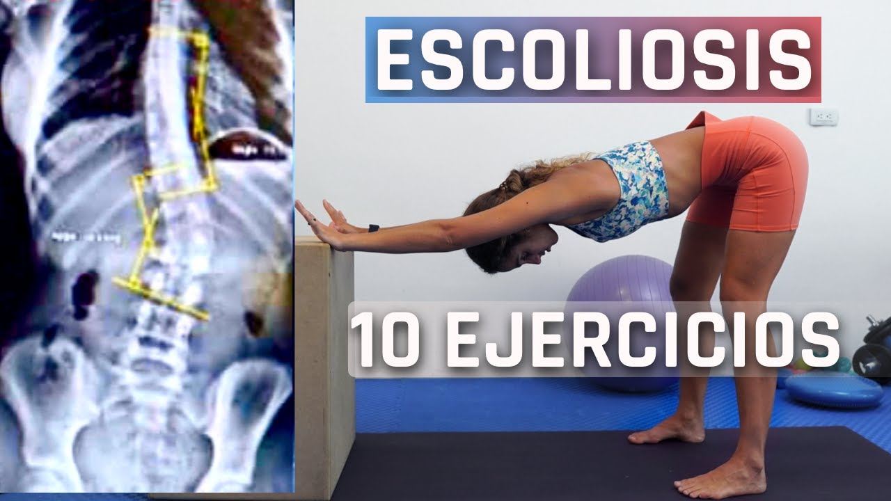 10-ejercicios-para-revertir-escoliosis-rehabilitaci-n-de-20-minutos