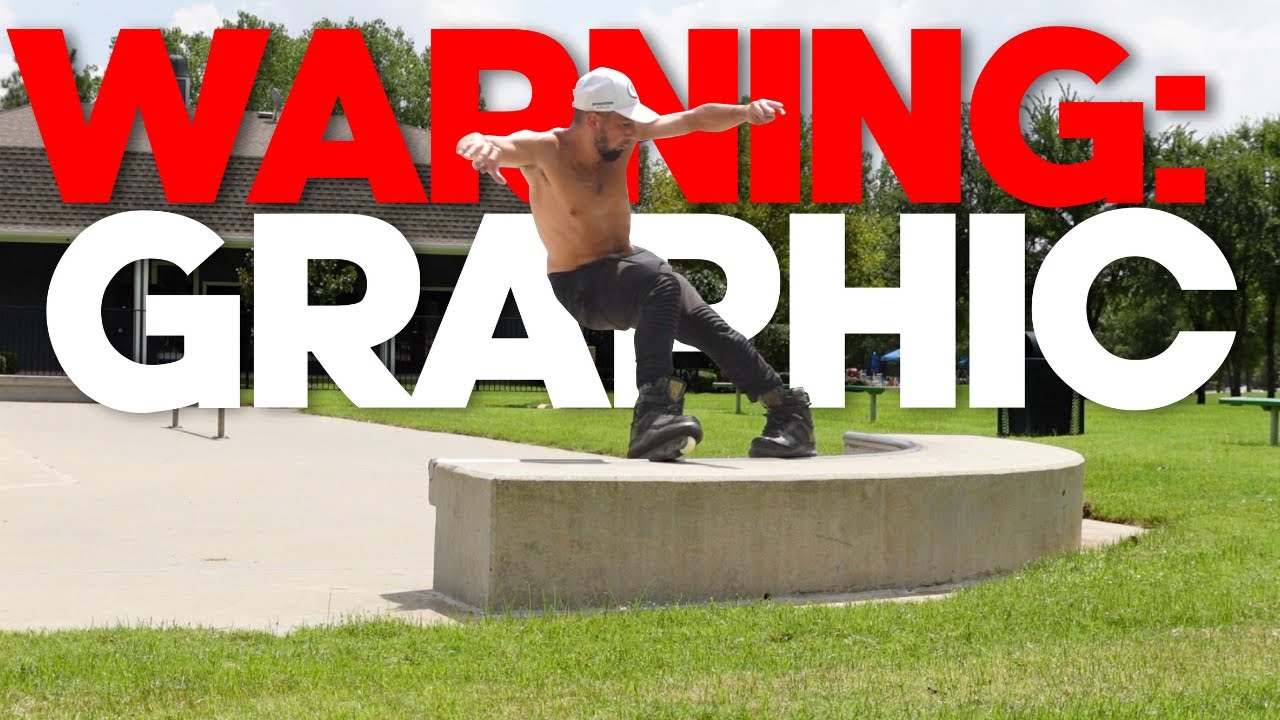 Rollerblader breaks fingers on grind switch up: ** WARNING GRAPHIC **