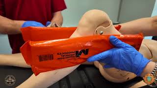 Splinting a Joint