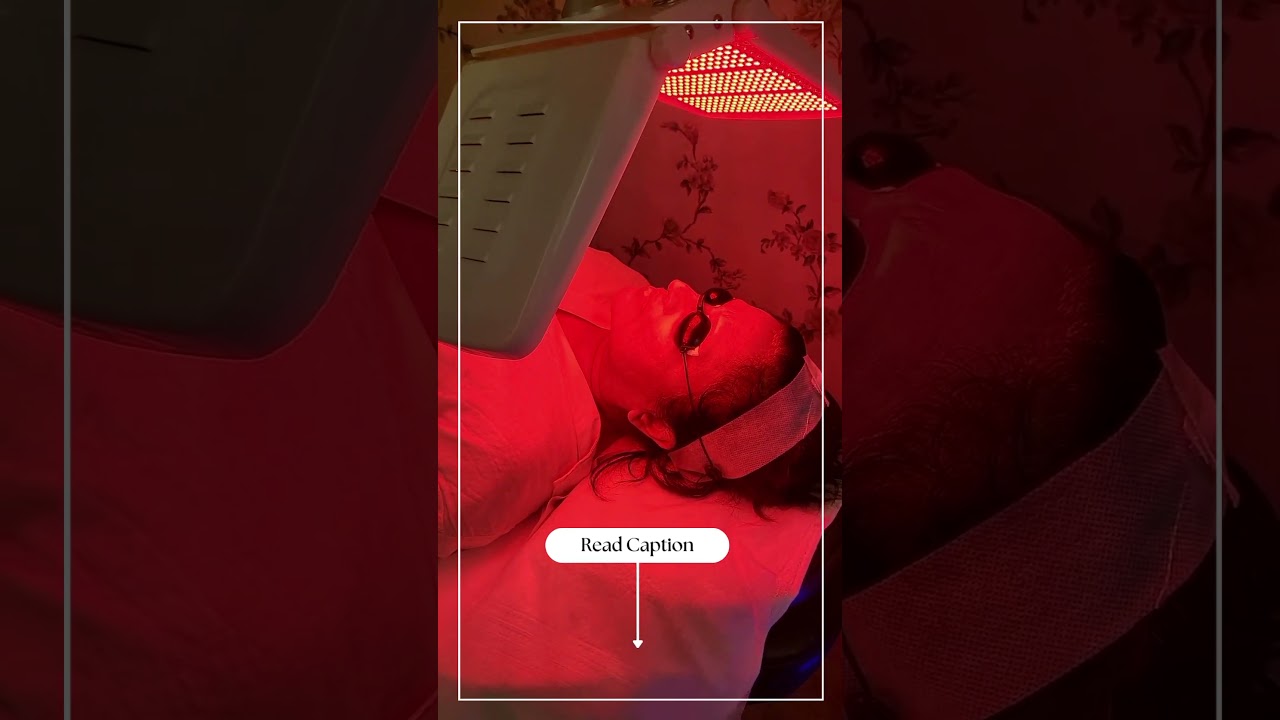 DermaFrac Treatment | Beyond Aesthetics Ns3