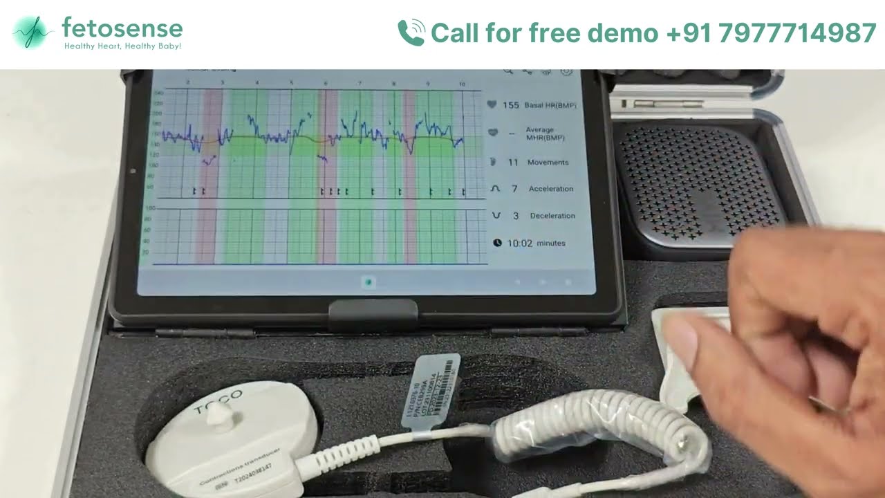 Fetosense smart NST/CTG machine, Call for free demo +91 79777149897