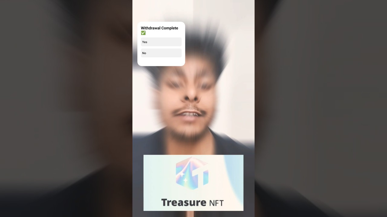 Treasure Nft wallet address  