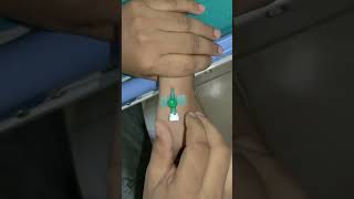 18G Green IV cannulation Technique| medical practitioner video's | doctor | iv cannula | #hospital