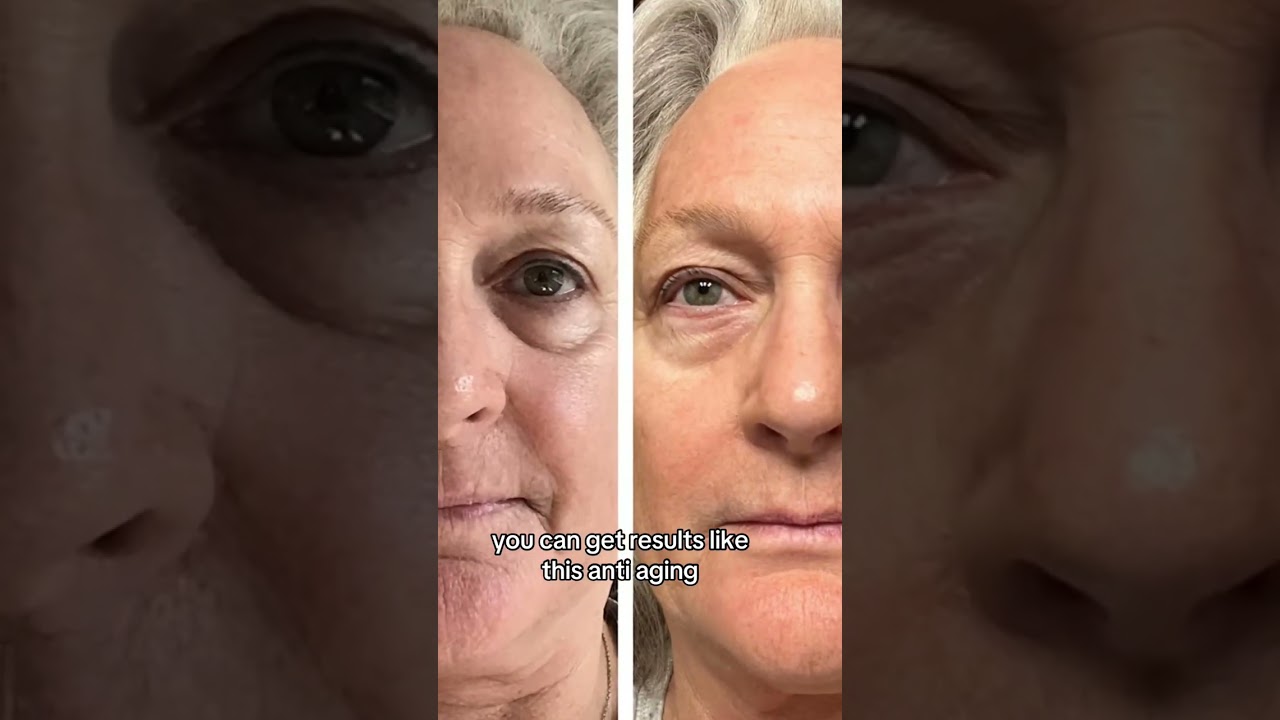 creatorsearchinsights ghk cu peptide before and after Copper Peptide serum  Copper Peptide peptide