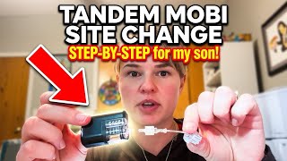 Tandem Mobi Insulin Pump Site Change For My Son: Step By Step Tutorial  screenshot 3