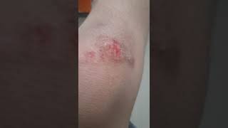 Yaralarımı Gösteriyorum