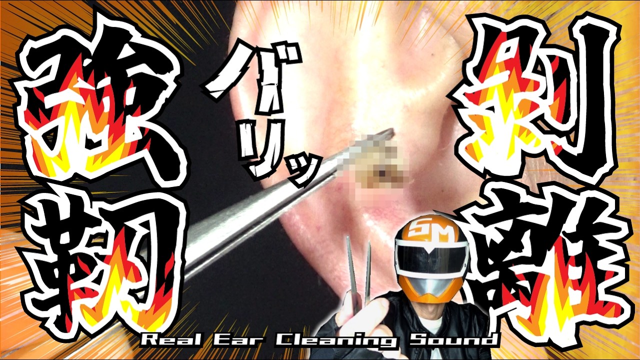 【深い眠りの底まで沈める強靭剥離破断音】～ピンセットが野獣の咆哮を轟かせた傑作選～耳掃除/引掻き音/音フェチ/マッサージ/痒み解消/睡眠導入【本物耳かきエンターテインメントASMR】