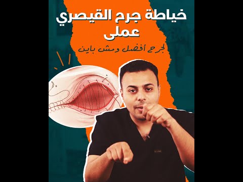 جرح القيصرية مش باين ازاي خطوات القيصرية وافضل خياطة للجرح 