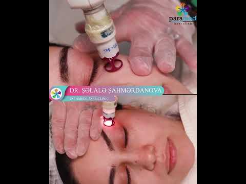 ClearLift lazer cavanlaşma