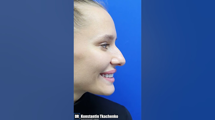 Ринопластика.В конце смотрите результат операции 😯 #ринопластика