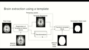 9.0 - MRI brain extraction using a template - Course MRI preprocessing with Python