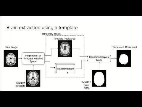 9.0 - MRI brain extraction using a template - Course MRI preprocessing with Python
