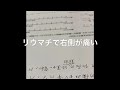 薬の影響で太ったとお悩みの関節リウマチの方