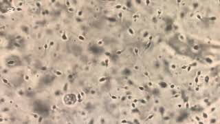 Sperm cell under the microscope