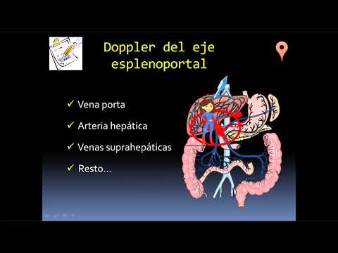 DOPPLER DEL EJE ESPLENOPORTAL