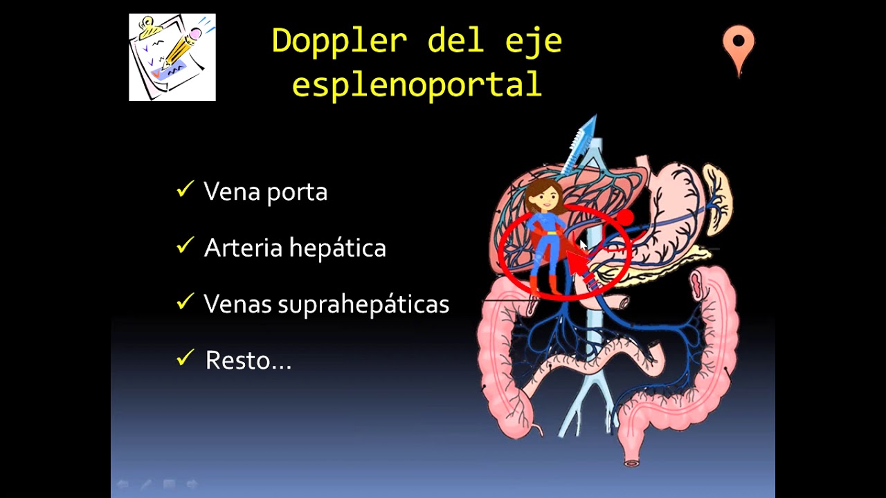 DOPPLER DEL EJE ESPLENOPORTAL