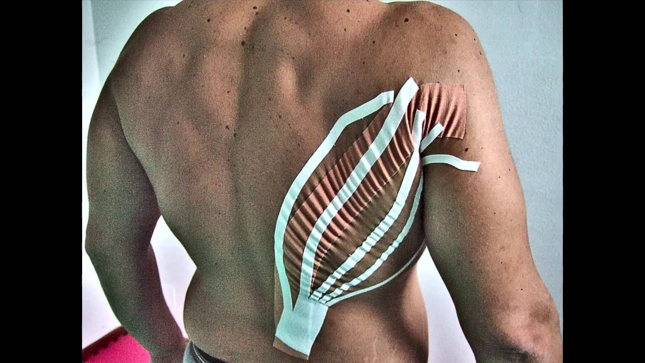 Dynamic Neurotaping Method: Demo combo colors tutorial