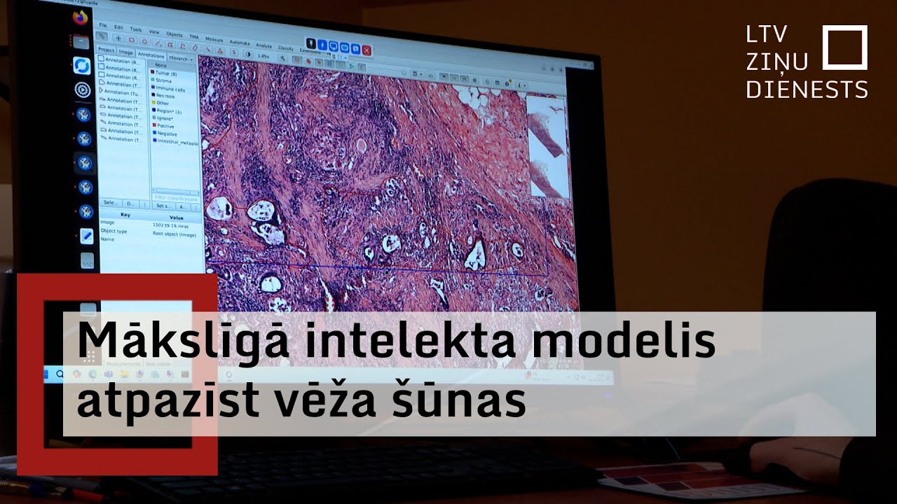 Mākslīgā intelekta modelis atpazīst vēža šūnas - YouTube