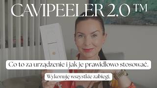 YONELLE CAVIPEELER 2.0 - co to za urządzenie, jak wykonać zabiegi w domu‼️