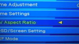 configuracion para la nfusion