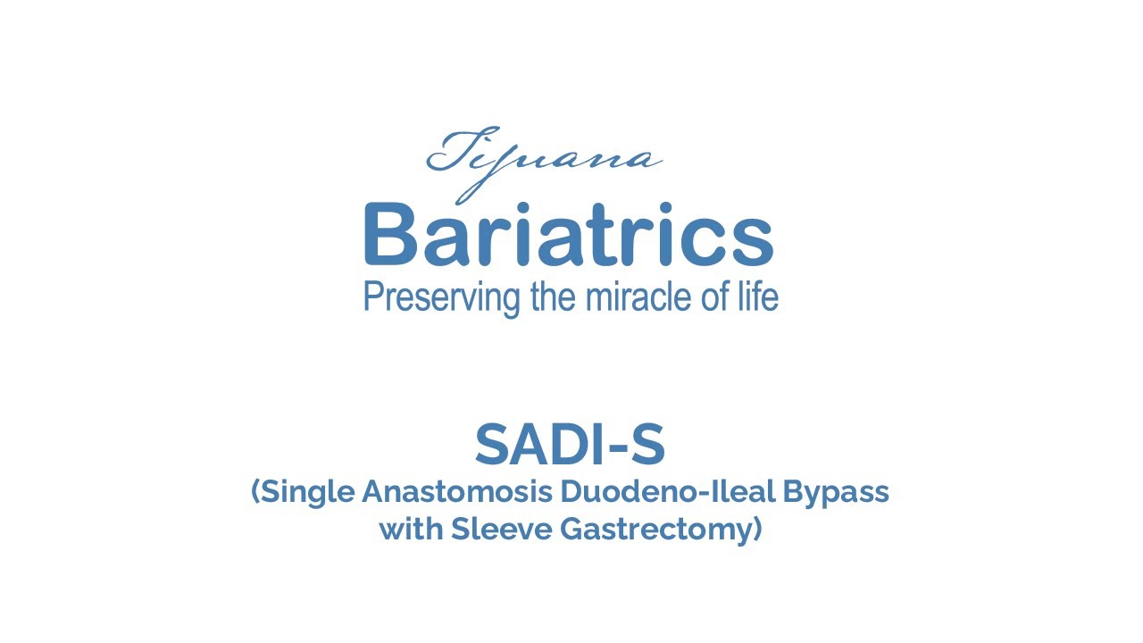 How SADI-S is Performed