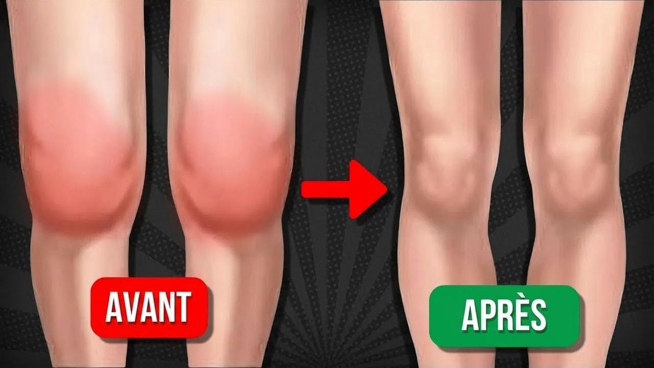 5 exercices efficaces pour dégonfler les genoux et éliminer l’excès de liquide