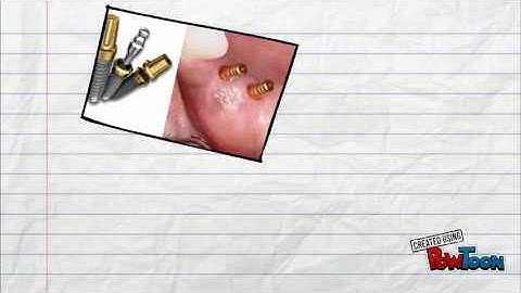 Functionally Graded Material