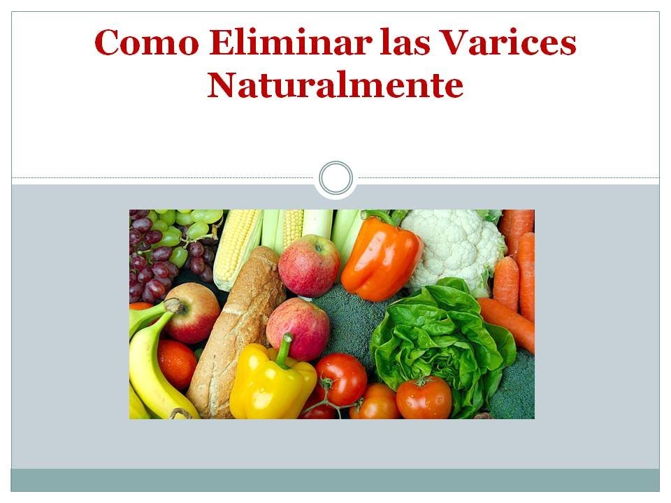 como eliminar las varices naturalmente Varices El Tratamiento Casero
