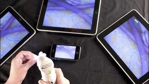 ProScope Mobile Launch