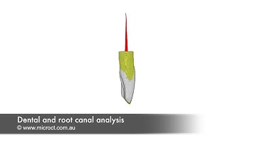 Dental and root canal analysis through microCT