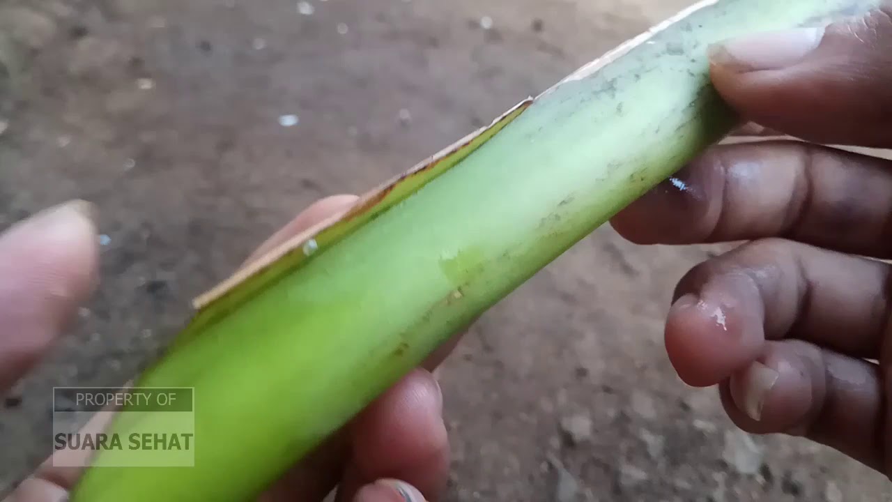 Cara mengatasi luka yang terkena pisau atau benda lain nya 