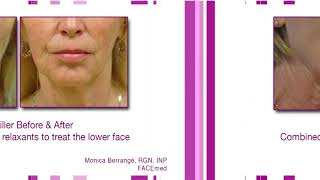 Before and after comparisons of FACEmed non surgical medical aesthetic treatments