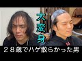 【ハゲ】髪を伸ばし続けた薄毛男子が念願のストパーで大変身