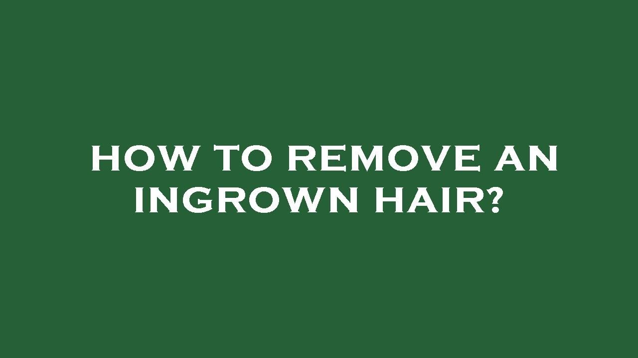How to remove an ingrown hair? YouTube