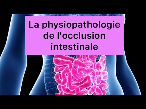 📍La physiopathologie de l'occlusion intestinale expliquée par khadidja  ferdj !🔥