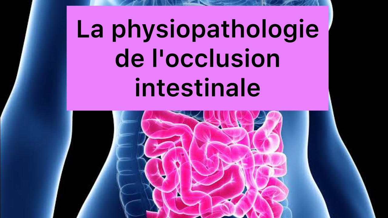 📍La physiopathologie de l'occlusion intestinale expliquée par khadidja  ferdj !🔥