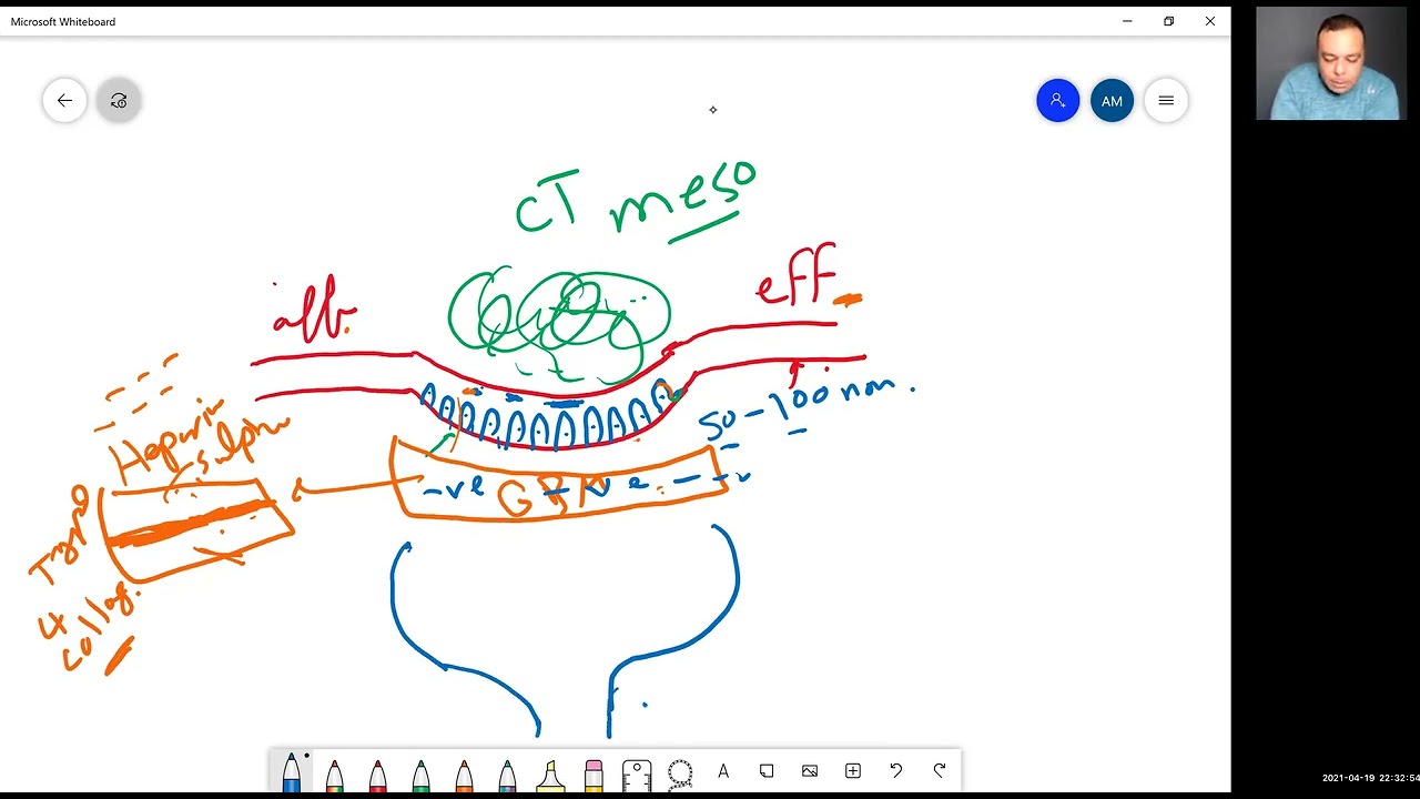 Glomerulonephritis GN