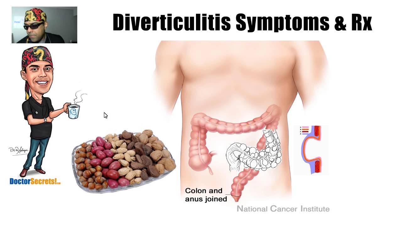What is Diverticulosis / Diverticulitis YouTube