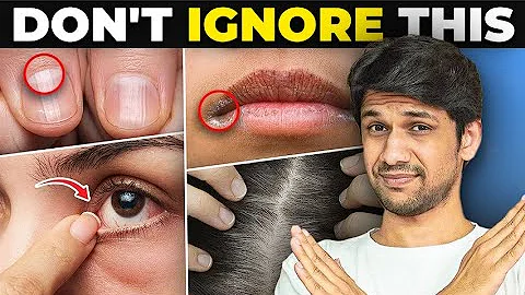 10 Signs of NUTRIENT DEFICIENCY | Facts, Symptoms & Bonus Tips | Saurabh Bothra