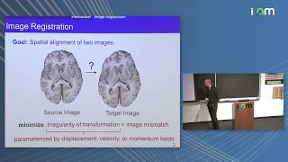 Marc Niethammer: "Deep Learning for Medical Image Registration" screenshot 4